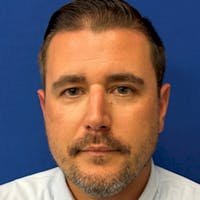 Bob Mitros at Lakeland Genesis